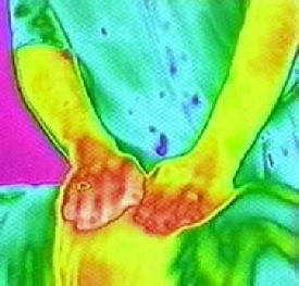 Hands may feel warm or cold as Reiki passes.